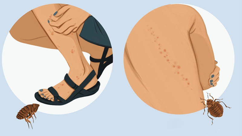 فرق ساس و گال