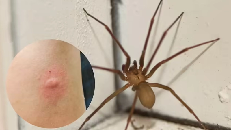 نیش عنکبوت خانگی